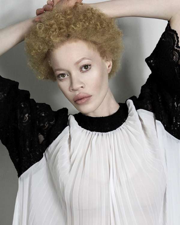Афроамериканка-альбинос - новая сенсация мирового модельного бизнеса